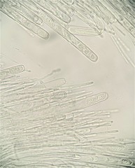 Trichaleurina tenuispora