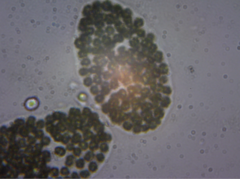 Microcystis wesenbergii