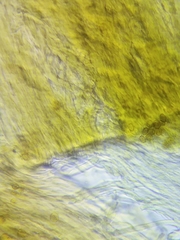 Inonotus cuticularis