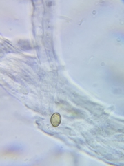 Inonotus cuticularis