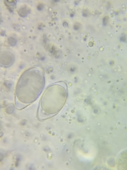 Oudemansiella limonispora