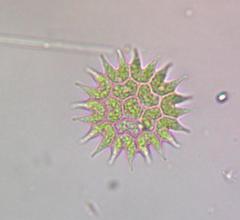 Pseudopediastrum boryanum longicorne