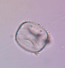 Stephanodiscus niagarae