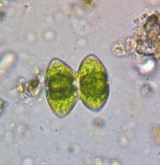 Staurastrum punctulatum