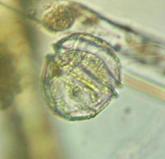 Peridinium gatunense