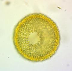 Uroglena