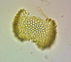 Uroglena