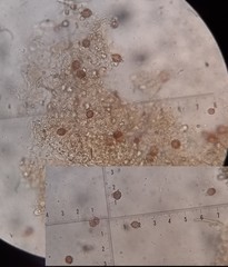 Descomyces