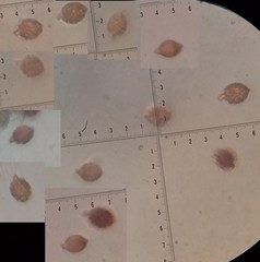 Descomyces