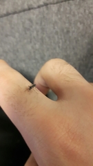 Aedes albopictus