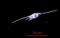 Kellicottia bostoniensis