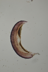 Tephromela pacifica