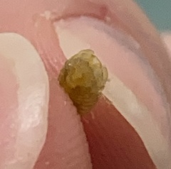 Sphaeroma quadridentatum