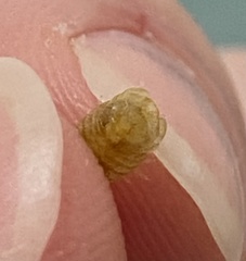 Sphaeroma quadridentatum