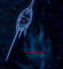 Kellicottia bostoniensis
