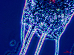 Kellicottia bostoniensis