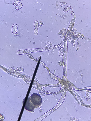 Podosphaera erigerontis-canadensis
