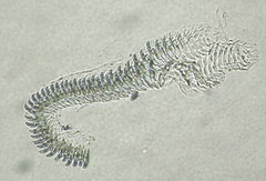 Atalodoris
