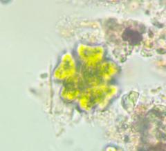 Sorastrum spinulosum