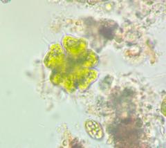 Sorastrum spinulosum