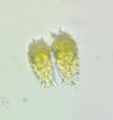Staurastrum hystrix