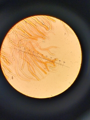 Dacrymyces variisporus