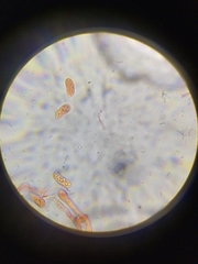 Dacrymyces variisporus