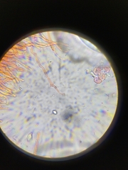 Dacrymyces variisporus