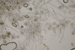 Peronospora chrysosplenii