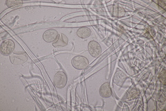 Peronospora chrysosplenii