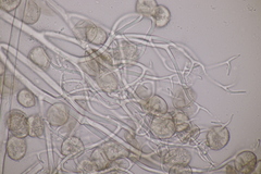 Peronospora chrysosplenii