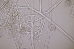 Peronospora chrysosplenii