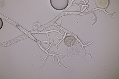 Peronospora chrysosplenii
