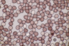 Microbotryum pustulatum