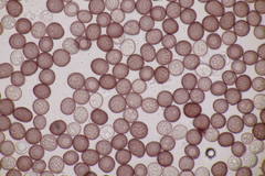 Microbotryum pustulatum