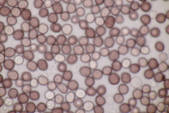 Microbotryum pustulatum