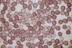 Microbotryum pustulatum