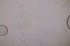 Ramularia macrospora