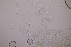 Ramularia macrospora