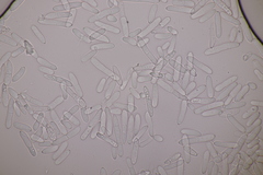 Ramularia macrospora