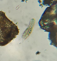 Chaetonotidae