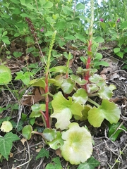 Umbilicus horizontalis