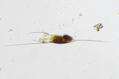 Kellicottia longispina