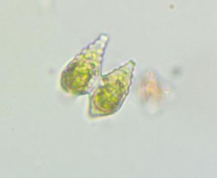 Staurastrum polymorphum