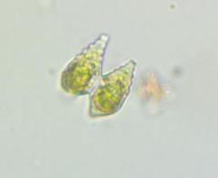 Staurastrum polymorphum