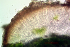 Lecania cyrtella