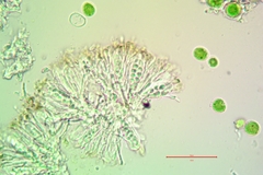 Lecania cyrtella