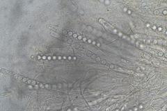 Pulvinula archeri