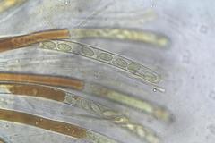 Peziza echinospora
