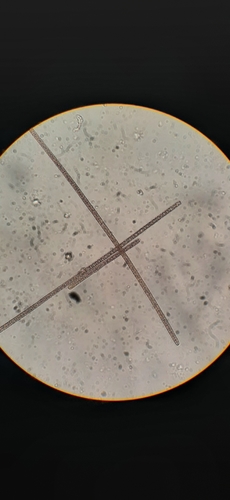 Planktothrix rubescens observed 2022-04-12
